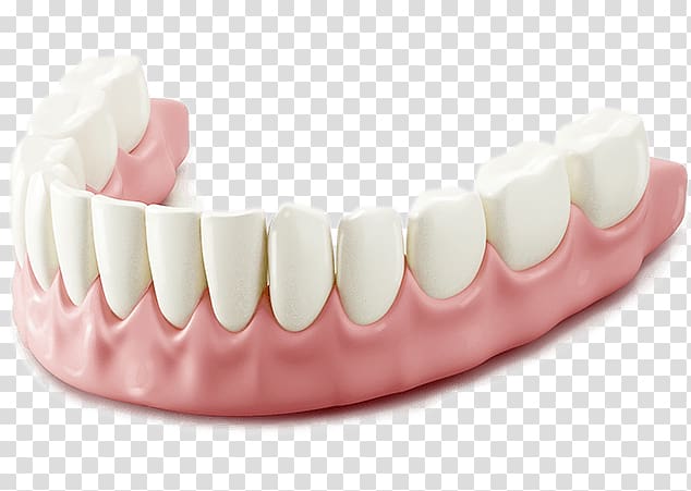Tooth Alveoloplasty Dentistry Dental extraction Dentures, gingival bleeding transparent background PNG clipart