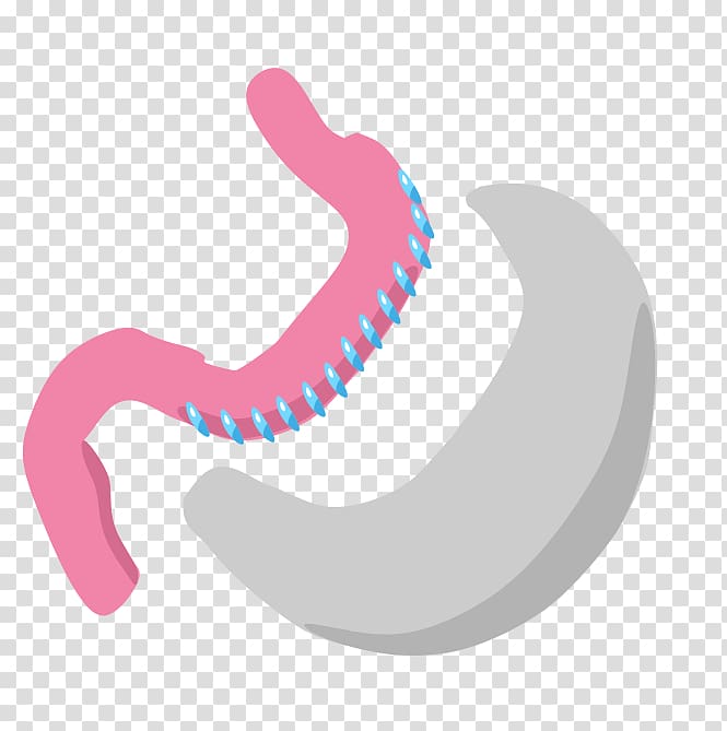 Sleeve gastrectomy Bariatric surgery Stomach Gastric bypass surgery, others transparent background PNG clipart
