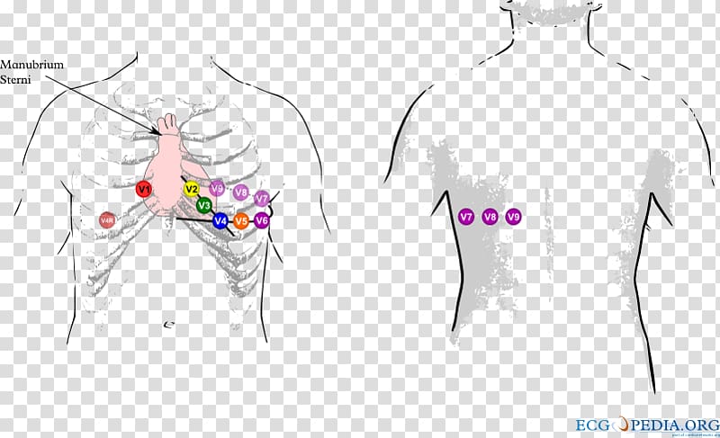 12 Lead ECG: The Art of Interpretation Electrocardiography Electrocardiogram Heart Cardiology, Myocardial Infarction transparent background PNG clipart