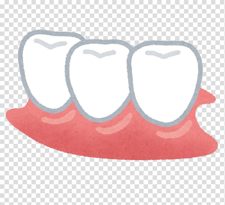 Dentures Dentist Tooth Removable partial denture Therapy, denture transparent background PNG clipart