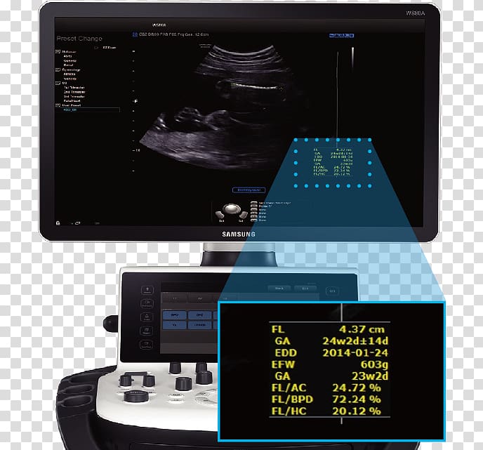 Ultrasound Ultrasonography Samsung Medison Samsung Electronics, Ob Gyn Pics transparent background PNG clipart
