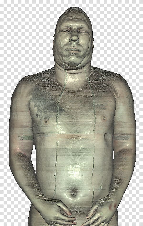 Joseph Paul Jernigan Visible Human Project Homo sapiens Anatomy Human body, ice block transparent background PNG clipart