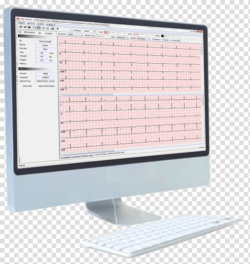Artun Medikal Teknik Servis Electrocardiography Spirometer Pulmonary function testing Vital capacity, Pulmonary Function Testing transparent background PNG clipart