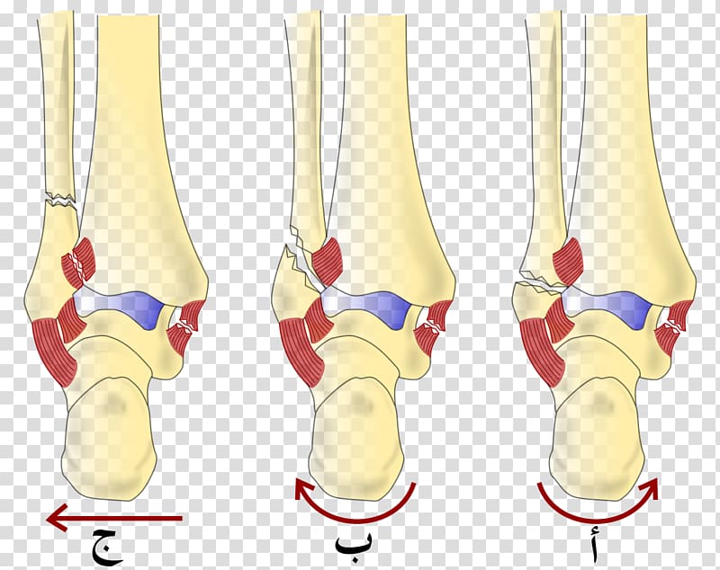 Danis–Weber classification Ankle fracture Lauge-Hansen classification Bone fracture Malleolus, Webber Books transparent background PNG clipart