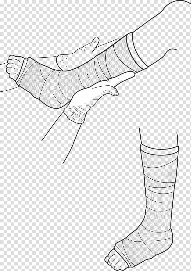 Human leg Drawing Orthopedic cast , legs transparent background PNG clipart