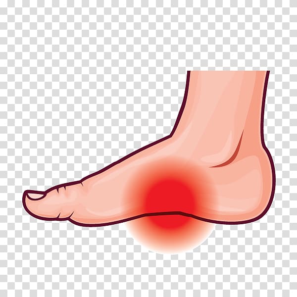 Thumb Arches of the foot Podalgia Plantar fasciitis, others transparent background PNG clipart