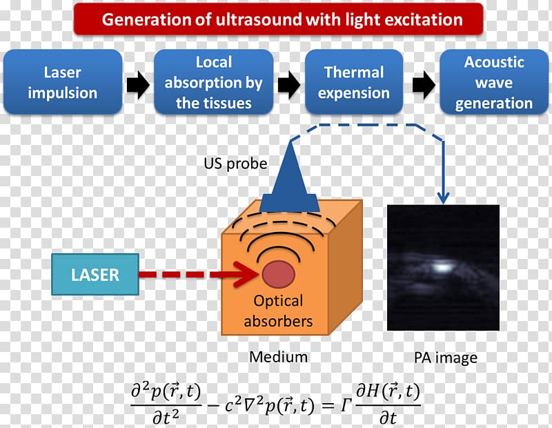 acoustic imaging Tomography Laser Ultrasound Medical imaging, light transparent background PNG clipart