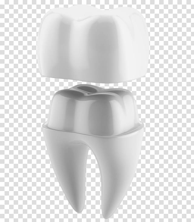 Crown CAD/CAM dentistry Tooth, crown transparent background PNG clipart