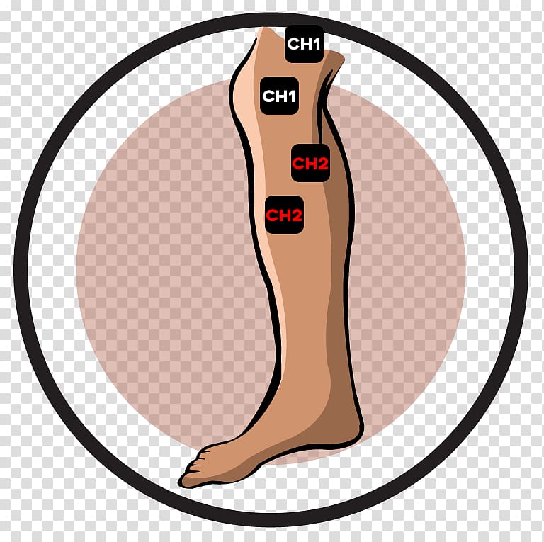 Finger Patellar subluxation syndrome Human leg Transcutaneous electrical nerve stimulation Electrotherapy, Neck muscle transparent background PNG clipart
