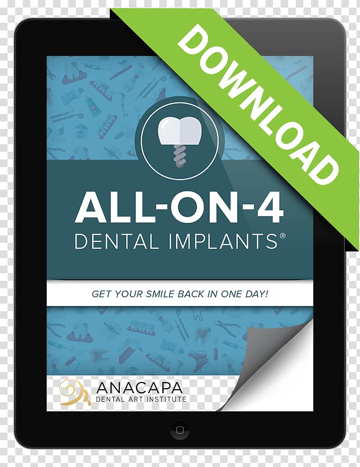 All-on-4 Dental implant Dentist Tooth Bellevue Dental Care & Implant Center, dental implants transparent background PNG clipart