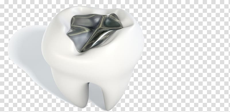 Tooth Amalgam Silver Dentistry Metal, decayed tooth transparent background PNG clipart