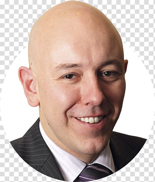 Alan Hurwitz Chief Financial Officer Management Forehead Cheek, others transparent background PNG clipart