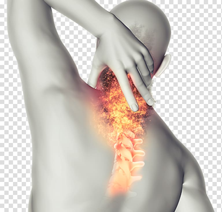 Neck pain Back pain Pain management Human back, others transparent background PNG clipart