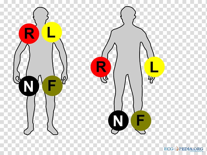 Electrocardiography Heart Disposable ECG Electrodes Limb Cardiac monitoring, placement transparent background PNG clipart