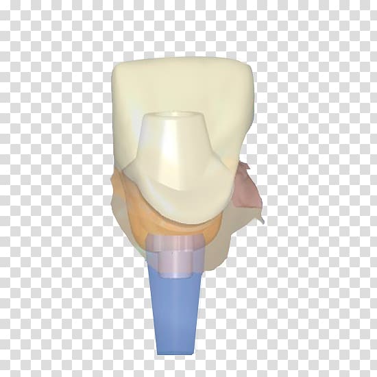 Dental implant Abutment Crown Zirconium dioxide, implant tooth transparent background PNG clipart