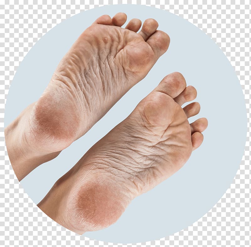 Foot Sole Callus Joint Hand, hand transparent background PNG clipart