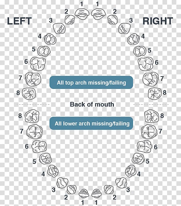 Dentistry Dental implant Oral hygiene Dentures, Dental Arch transparent background PNG clipart