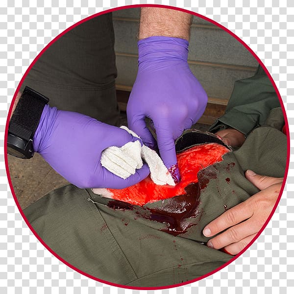 Dressing Antihemorrhagic Wound Hemostasis Injury, Wound transparent background PNG clipart