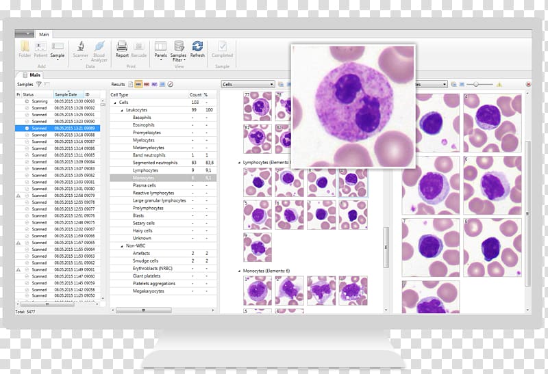 Hematology Complete blood count White blood cell Microscope, microscope transparent background PNG clipart
