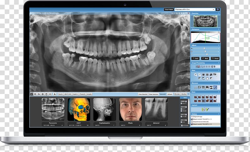Dentistry Medicine Medical imaging Dental radiography Computer Monitors, others transparent background PNG clipart