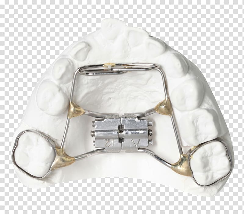 Orthodontics Tooth Clear aligners Retainer Dental braces, tongue transparent background PNG clipart