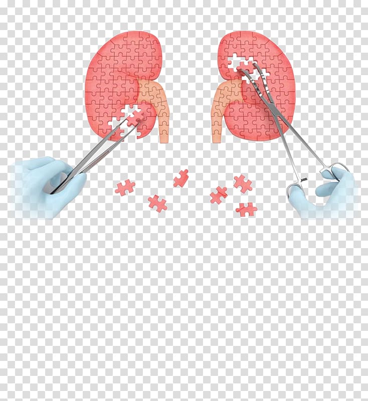 Chronic kidney disease Kidney transplantation Organ Polycystic kidney disease, kidney transparent background PNG clipart