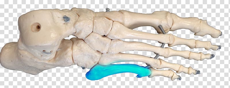 Jones fracture Bone fracture Metatarsal bones Carolina Panthers Joint, others transparent background PNG clipart