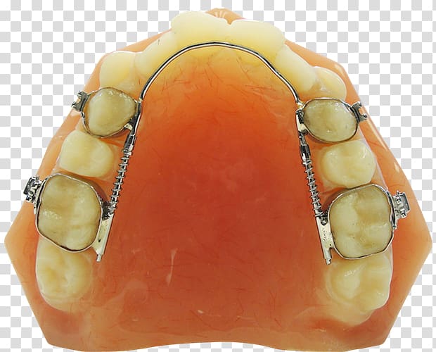 ROA, Ricoh Orthodontic Appliances Orthodontics Home appliance Orthodontic technology Dentistry, others transparent background PNG clipart