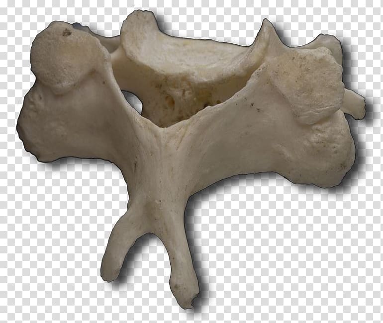 Human vertebral column Cervical vertebrae Atlas, vertebral transparent background PNG clipart