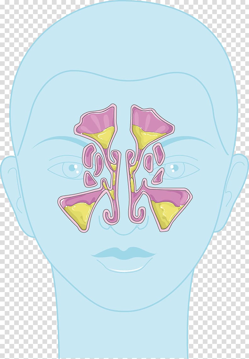Nose Sinus infection Child Chronic condition Swelling, nose transparent background PNG clipart