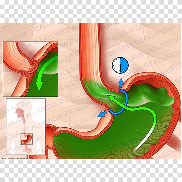 Esophagus Upper esophageal sphincter Cardia Sfintere esofageo inferiore, others transparent background PNG clipart