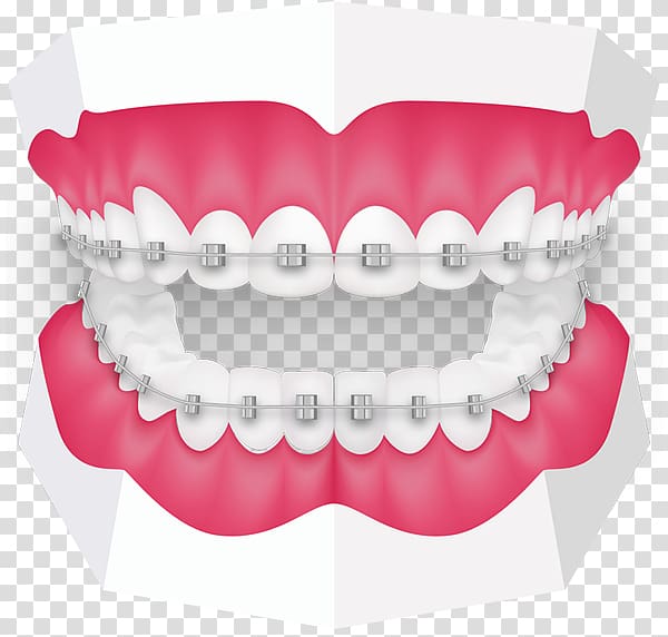 Tooth Orthodontics Dentistry Dental braces Oral hygiene, Orthodontist transparent background PNG clipart
