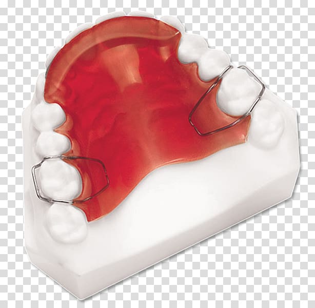 Twin Block Appliance Jaw Alaleuanluu Dental braces Chin, others transparent background PNG clipart