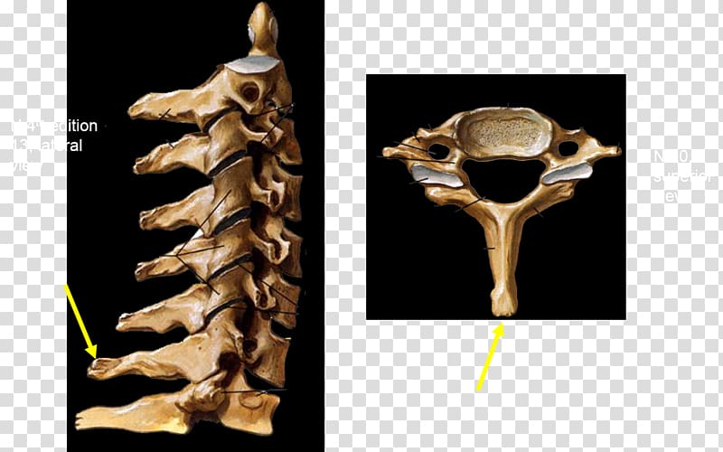 Vertebra prominens Vertebral column Cervical vertebrae Sacrum, mid ad transparent background PNG clipart