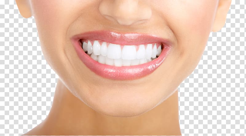 Tooth whitening Human tooth Cosmetic dentistry, White Teeth transparent background PNG clipart
