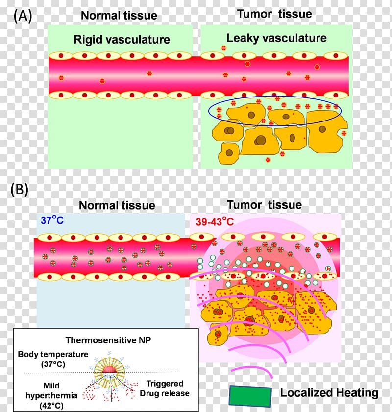 Liposome Drug delivery Enhanced permeability and retention effect Nanoparticle Pharmaceutical drug, drug-delivery transparent background PNG clipart