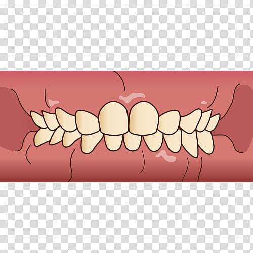 Tooth Dentist 歯科 Prognathism Dental hygienist, kids Dental transparent background PNG clipart