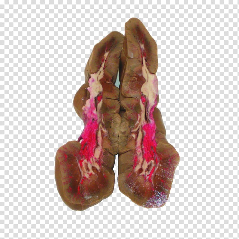 Calf Beef Organ Kidney Pail, Liver Fluke transparent background PNG clipart