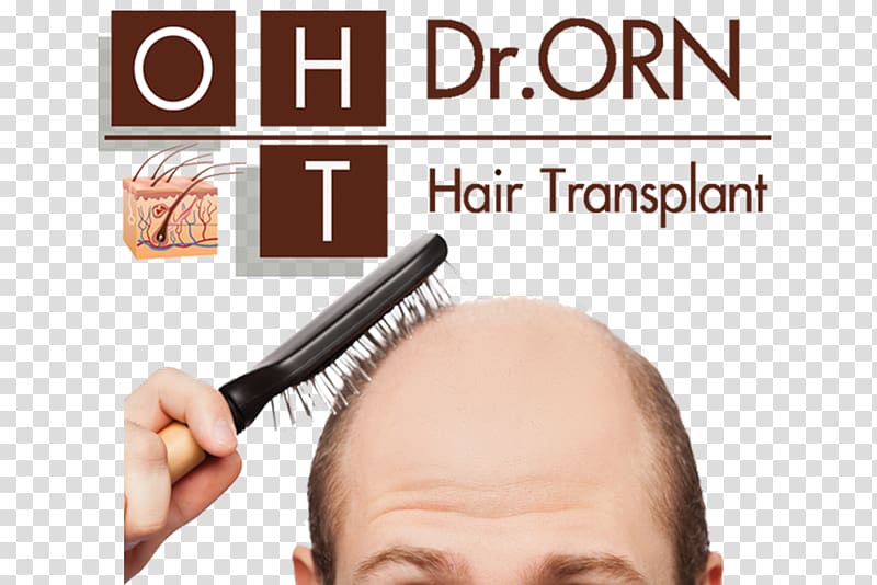 Management of hair loss Hair transplantation Platelet-rich plasma Therapy, hair transparent background PNG clipart