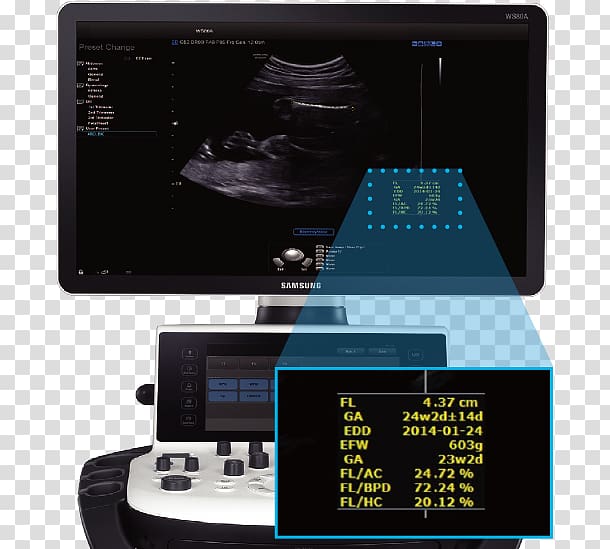 3D ultrasound Samsung Medison Ultrasonography Consumer electronics, samsung transparent background PNG clipart