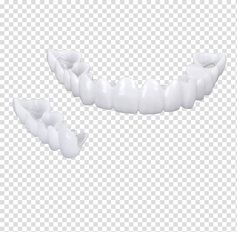 Veneer Dentures Tooth whitening Dentistry, Teepee transparent background PNG clipart