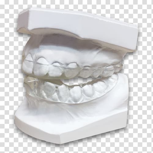 Jaw Tooth Bruxism Dentistry Splint, Dental Laboratory transparent background PNG clipart