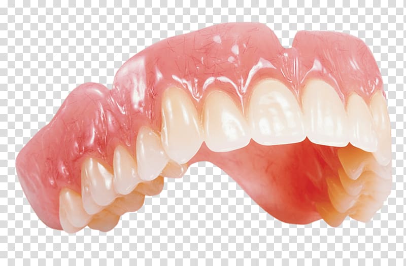 Dentures Removable partial denture Dentistry Dental laboratory Crown, chewing gum transparent background PNG clipart