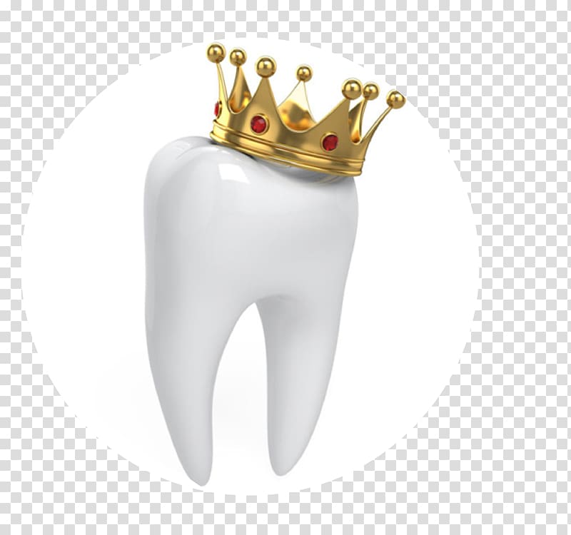 Crown Dentistry Human tooth, crown transparent background PNG clipart