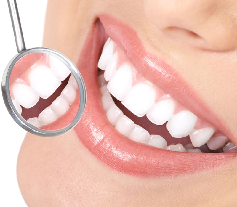 Dental Care of Nixa Cosmetic dentistry Oral hygiene, Tooth transparent background PNG clipart