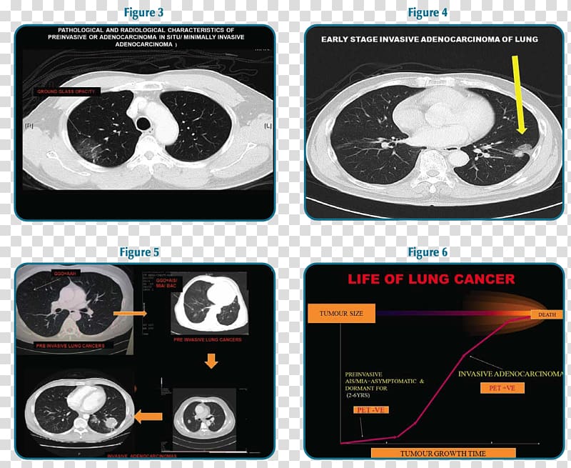 Brand Technology, lungs surgery transparent background PNG clipart