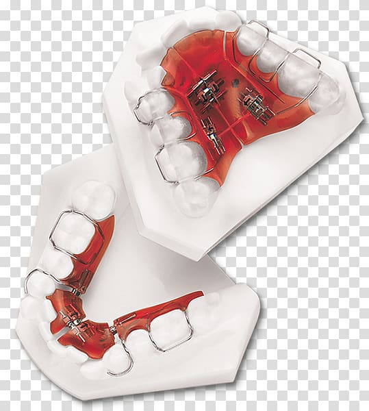 Sagittal plane Coronal plane Occlusion DynaFlex, Orthodontic correction transparent background PNG clipart