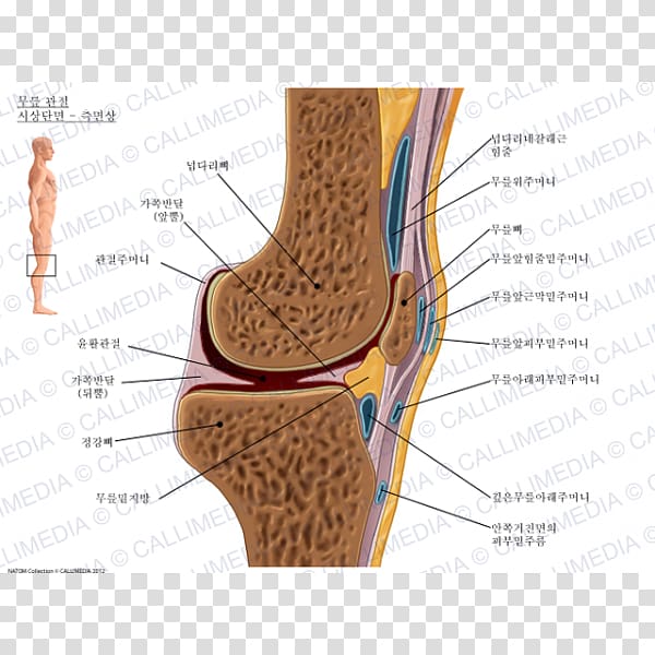 Prepatellar bursitis Synovial bursa Infrapatellar bursitis Knee, artrosis de rodilla transparent background PNG clipart