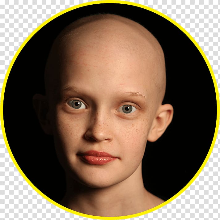 Kylie Jenner The Monster Cancer Eyebrow, childhood cancer transparent background PNG clipart