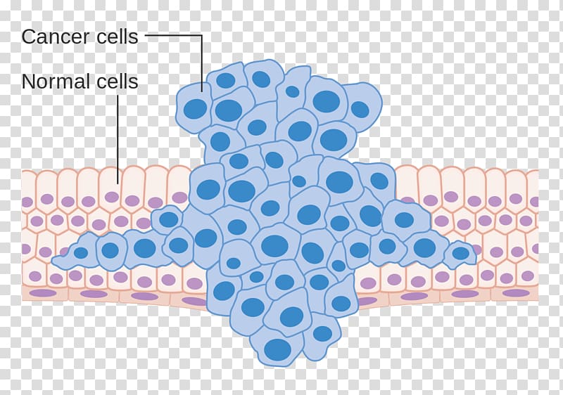 Cancer cell Metastasis Neoplasm, various cancer cells transparent background PNG clipart